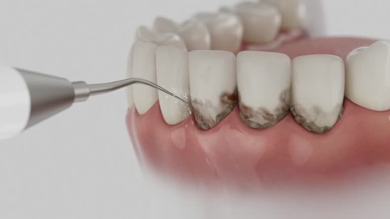 Trusted Dental Crowns And Bridges service in Rosamond, CA - Dentist Open Now